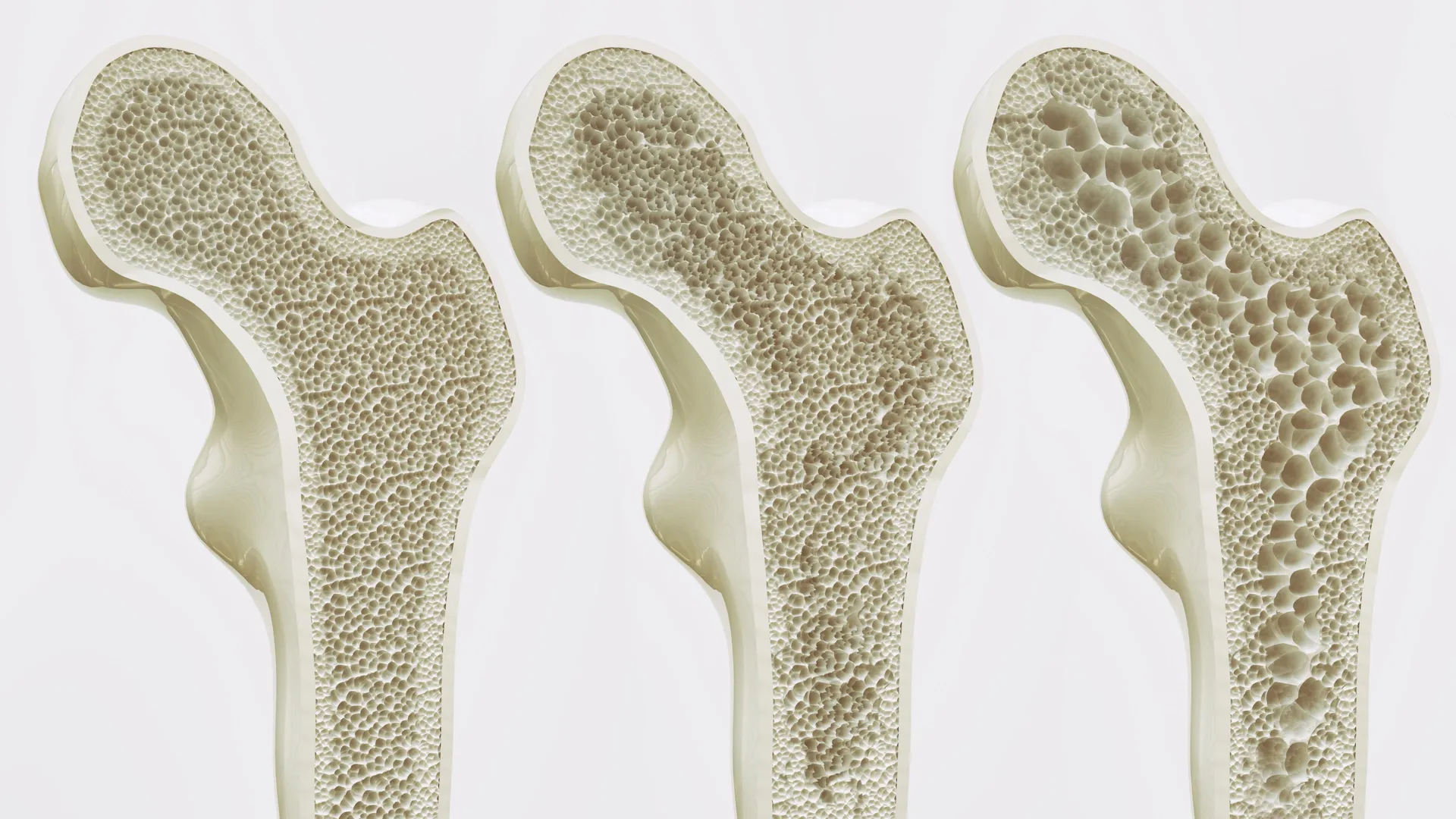 Major Review Questions Routine Calcium and Vitamin D Supplements for Older Adults